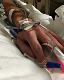DH’s Shoulder Surgery – Just in case You’re interested